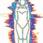 Person 1932 mit EMC