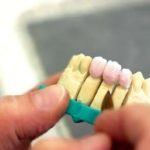 Auftragen der EM Prima Vital Keramik